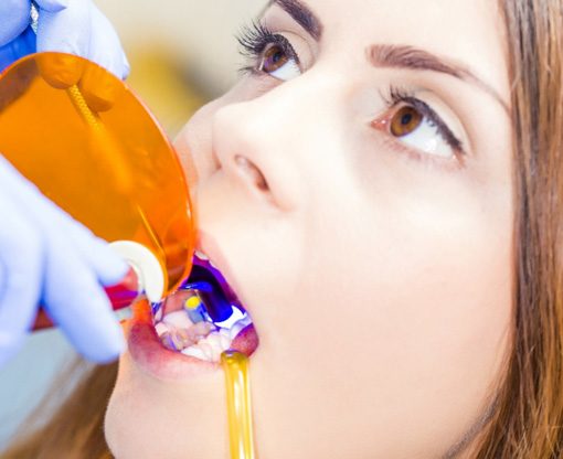 a patient undergoing dental bonding in Carmel