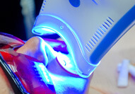 patient in Carmel getting teeth in-office whitening